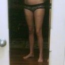 side before surgery