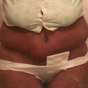 3 wks, no cg, swollen, hunched over