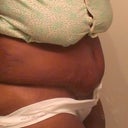 3wks side lipo