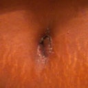 Belly button at 3 week. the pic don't do it justice. I'ts swollen but I have to get really close to see the incisions.