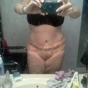 8 weeks post op