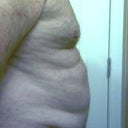 Before - Right Profile (285 lbs)