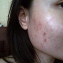 another cheek, week 3.