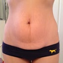 Before- sucking in a little