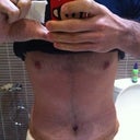 Post Op - Day 4 - First thing in the morning, still not standing up 100% straight but vast improvement.