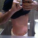 Post Op - Day 4 - First thing, swelling is way less then yesterday.