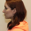 Before - profile view, left