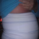 4 days po and still very swollen. side view