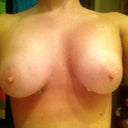 one week post op
