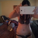 front 13days post op