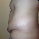 Before picture