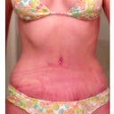 4 weeks PO