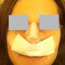 Day of surgery (p.m.)