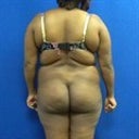 Bra roll, no booty & dimples. #UGH.