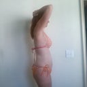 Pre Op Side View