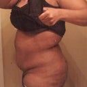Pre-op