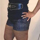 BEFORE surgery....It's amazing how a girdle can hide the bulge lol