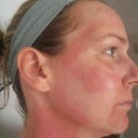 Side view - uneven application?