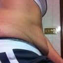 Pre-op Sitting Side View....Mmmmm....Muffin top!