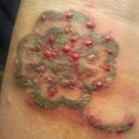 Treatment 1, Day 3