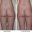 Surgery 1 - No results