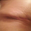 Left dog ear