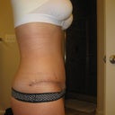 side