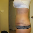 other side