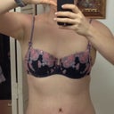 Amazing! 6 weeks post-op!