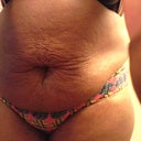 Can't wait till it's over and I have a flat stomach....