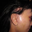 Stitches around the ears. Total of about 60 plus about 20 on forehead