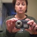Here is a before pic.  Lots of loose skin around mouth and cheecks