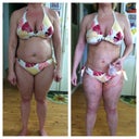 before and 3 days after surgery
