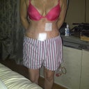 5 days after surgery, feeling great!
