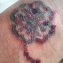 Treatment 1 Day 6