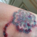 Treatment 1 Day 6