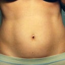 BEFORE:  front view
