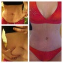 Before and After @ 12 weeks post op. LOVE!