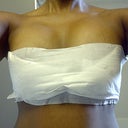 Day 4 Post-op