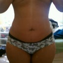 Several hours before my procedure....front