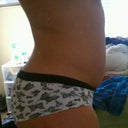Side...before surgery