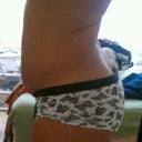 Another side view before surgery....