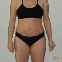 4 weeks post op