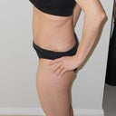4 week post op side on
