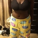 7 days post op front view