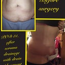 Here's some side by side before and afters, since I am bored, and finally seeing some difference!