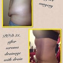 Another side by side before and after :)