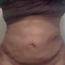 2 days post op! i had alot of lumps the previous day but i got a tighter garment and it has flattened and shaped me of course I still have swelling that is to be expected. I just hope the extra skin at he bottom will bounce back and smooth out as well....The lmps wer horrible but they are gone I will post that pic soon