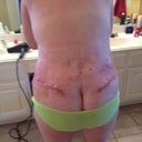 Day 4 Back