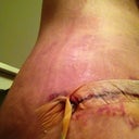 Drain site 2
